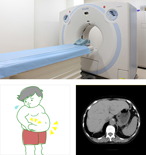 CT検査の主な診断